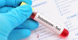 Testosterone